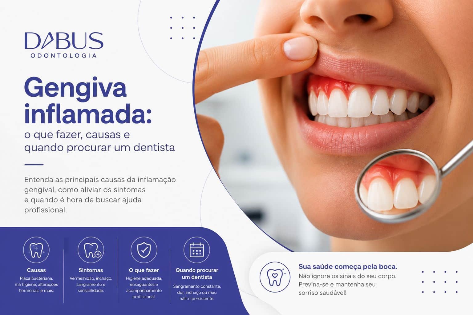 gengiva inflamada tratamento Bauru