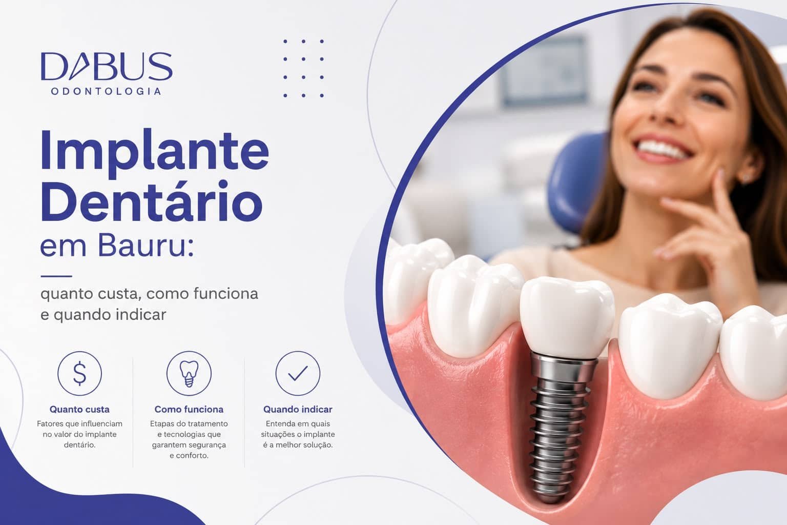 Ilustração de implante dentário com paciente sorrindo em consultório odontológico, representando o tratamento de implante dentário em Bauru e suas indicações.