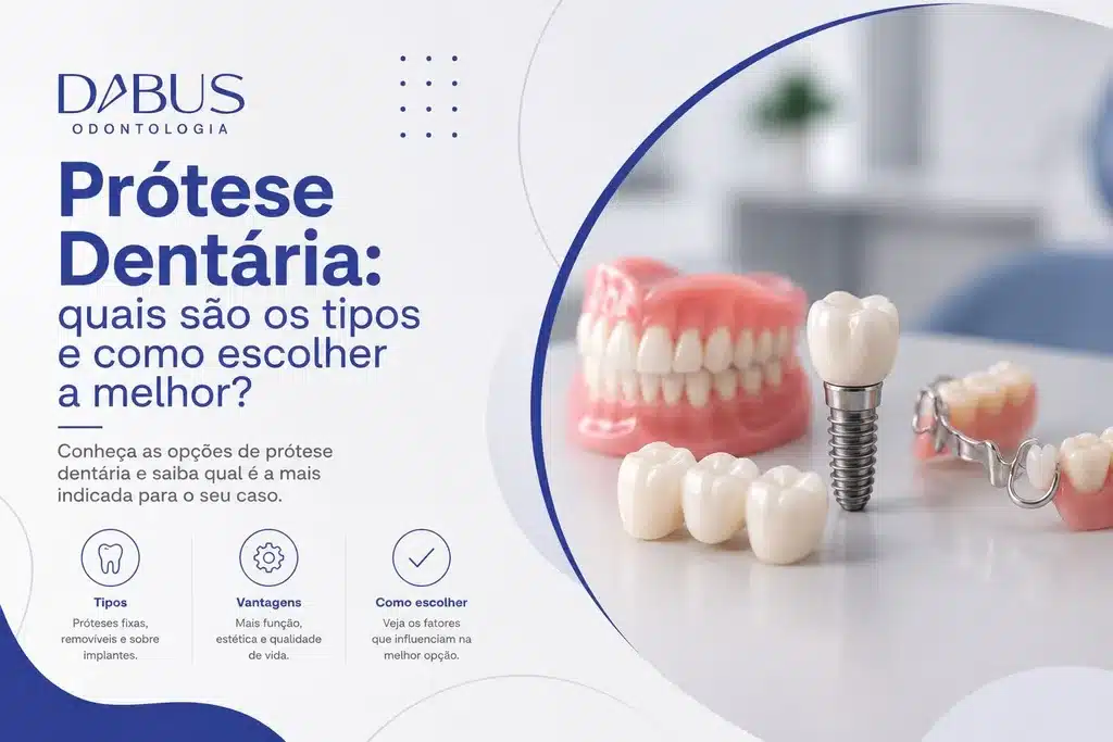 Tipos de prótese dentária e opções de tratamento para substituir dentes perdidos na Dabus Odontologia, em Bauru.