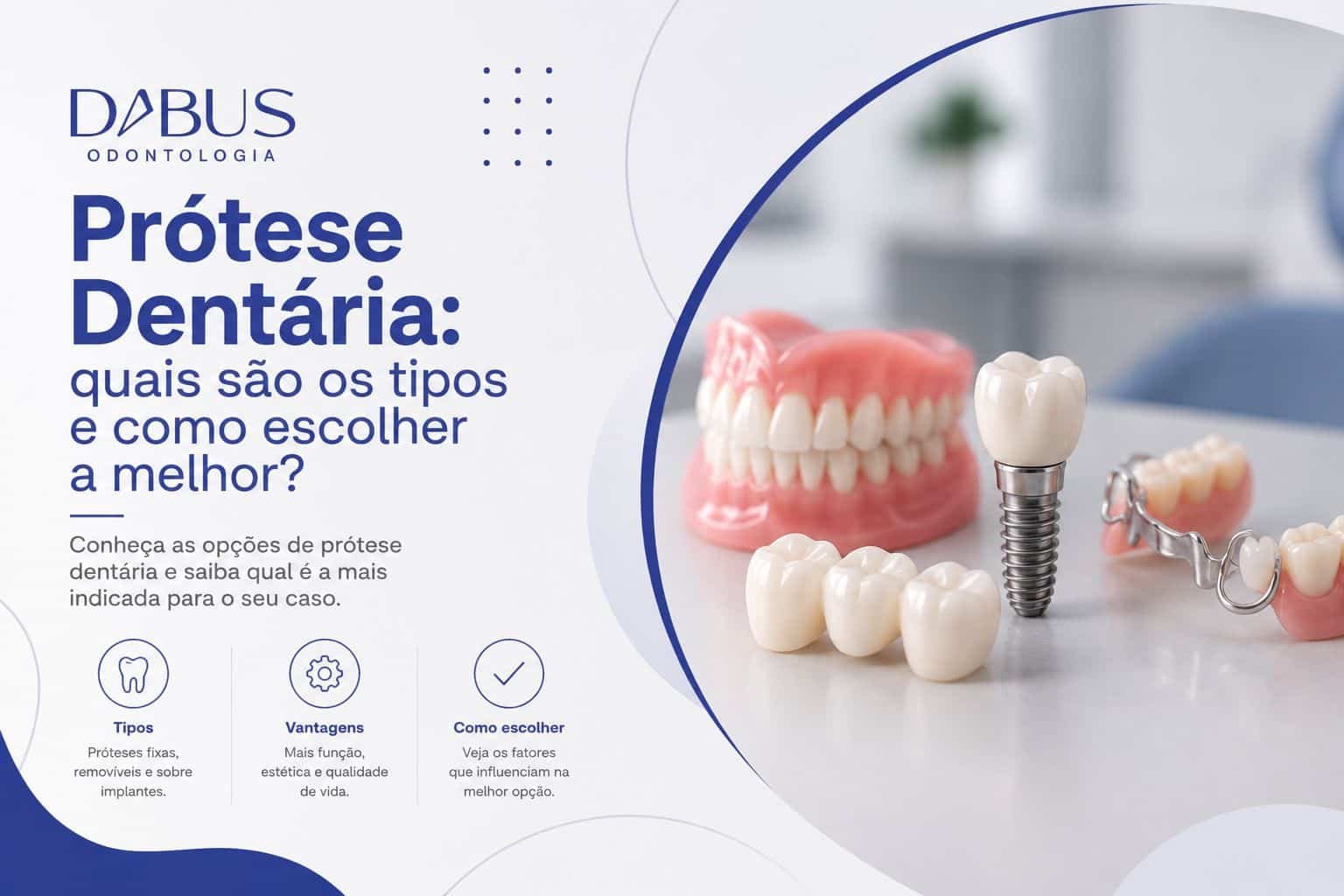 Tipos de prótese dentária e opções de tratamento para substituir dentes perdidos na Dabus Odontologia, em Bauru.