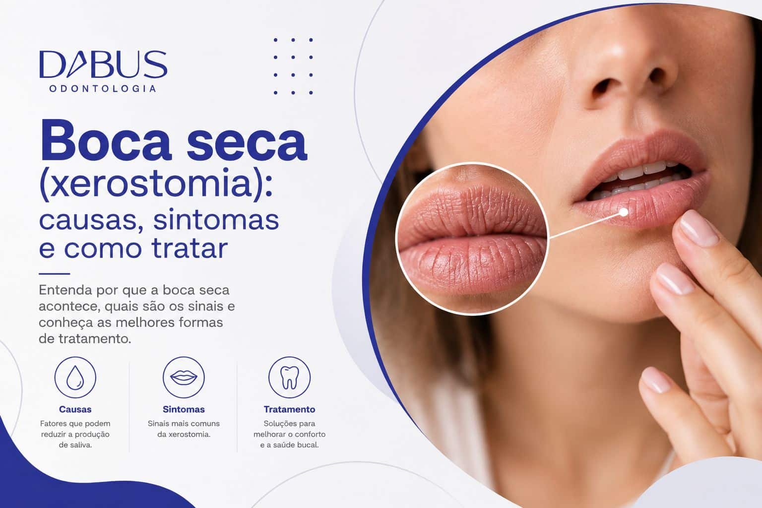 Boca seca ou xerostomia: causas, sintomas e tratamento na Dabus Odontologia em Bauru.